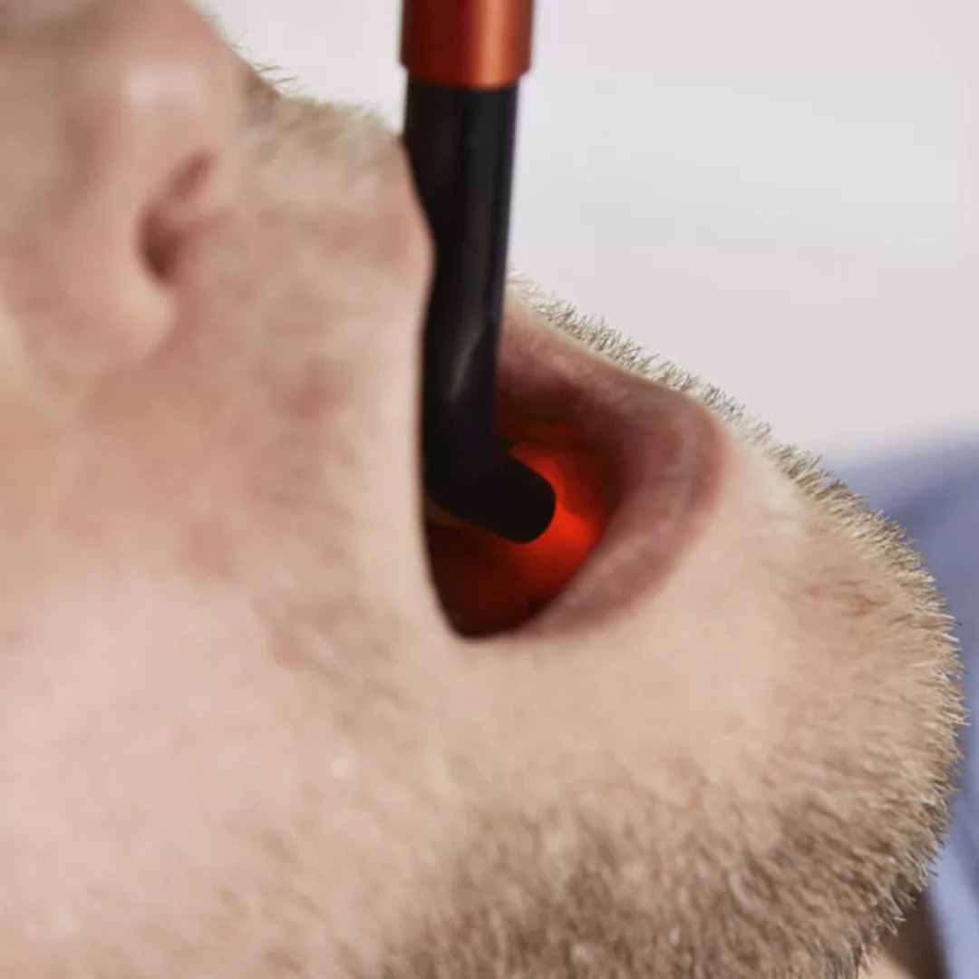 Energy-Laser L500 Pro lágylézer - Image 7