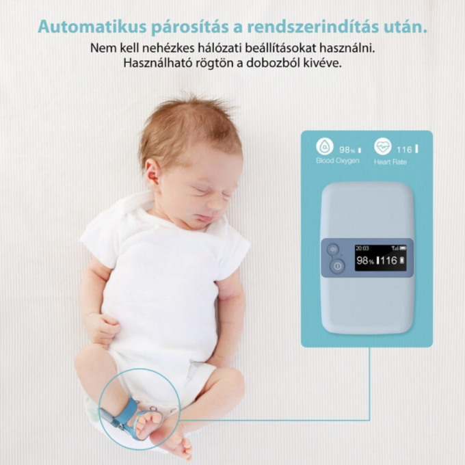 Viatom Baby O2 S2 Légzésfigyelő készülék külső állomással (véroxigénszint, pulzus, mozgás) - Image 2